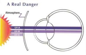 UV-straling